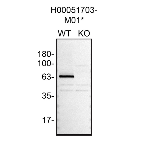 WB Image