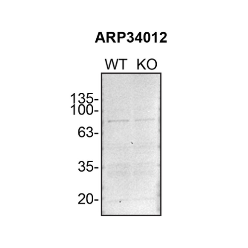 WB Image