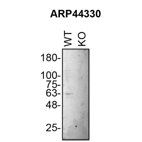 WB Image
