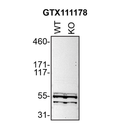 WB Image