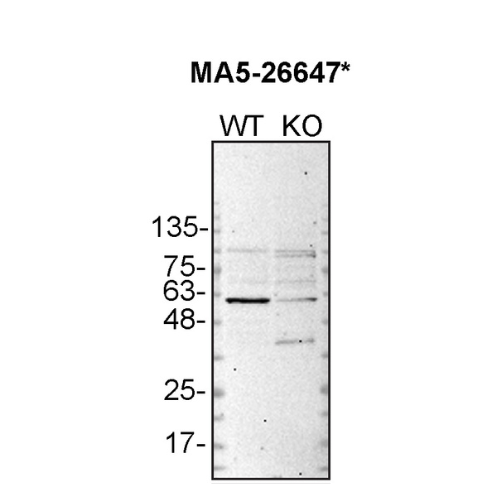 WB Image