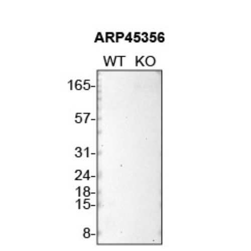 WB Image