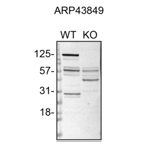 WB Image