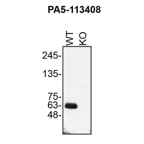 WB Image